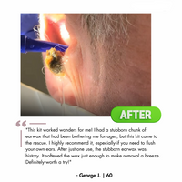GoPostery™ Electric Ear Wax Removal Kit